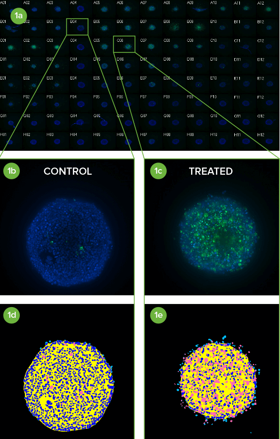 Rapidly screen 3D spheroids in microplates
