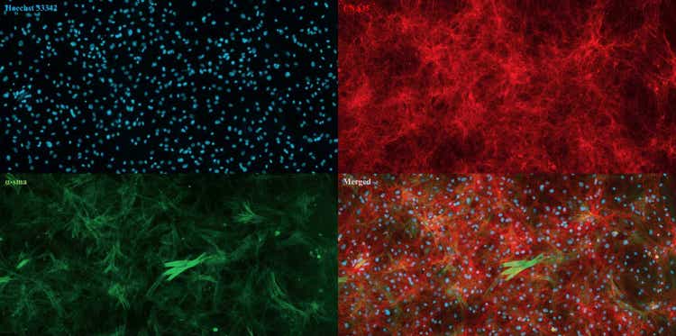 Images acquired using ImageXpress Pico Automated Cell Imaging System of cultured dermal fibroblasts isolated from cow skin. Nuclei (blue), collagen (red), alpha-smooth muscle actin (green)